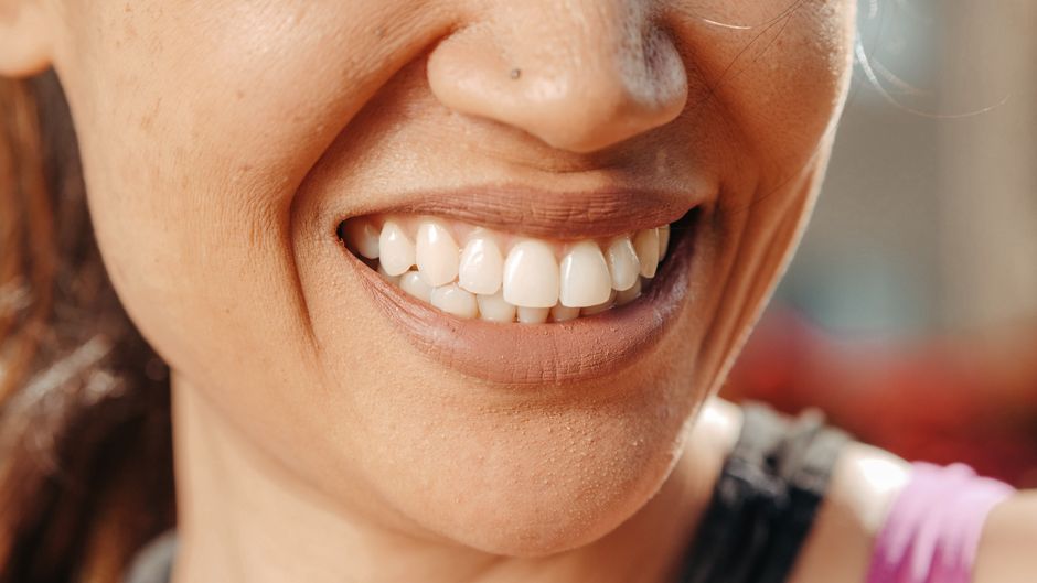 Paciente con sonrisa sana después del tratamiento